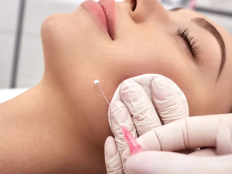 neck lift redondo beach