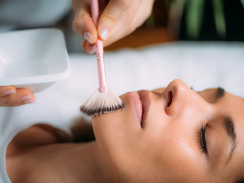 suitable candidate for chemical peels