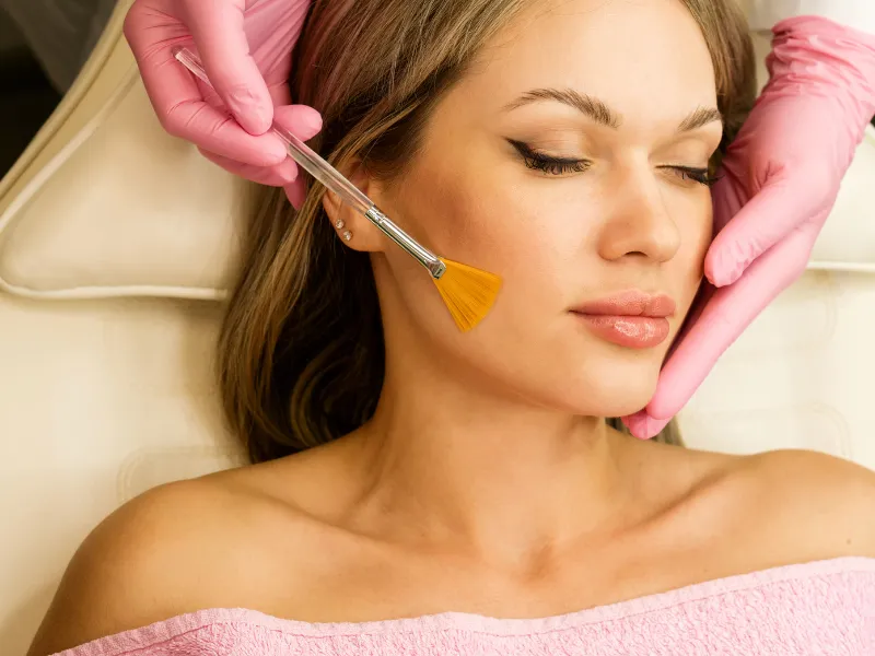 the role of chemical peels