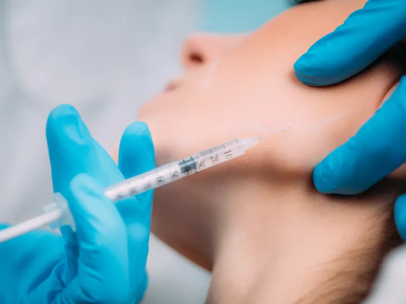 what are dermal fillers