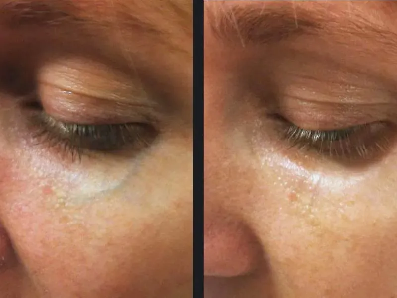 before and after transformation