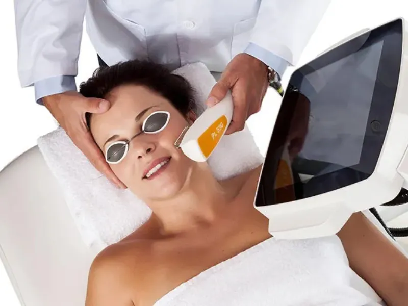 IPL laser treatment cost