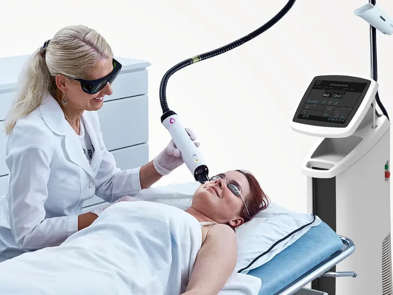 nordlys ipl laser treatment los angeles ca