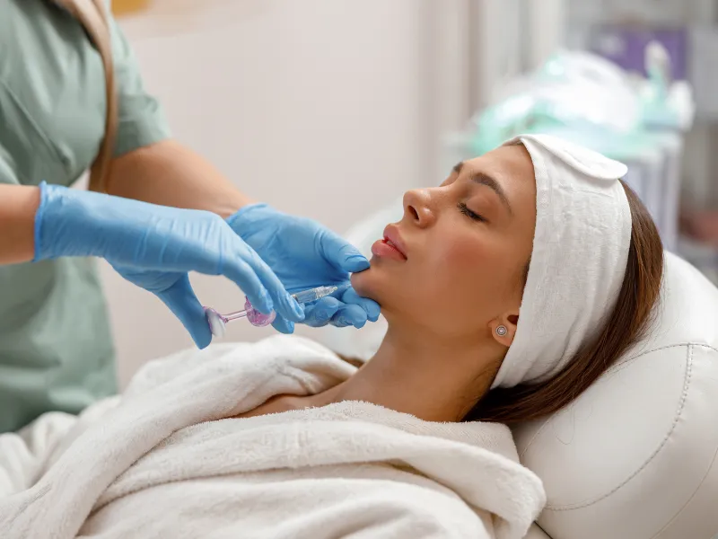 radiesse filler areas