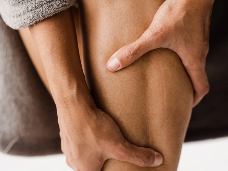 after sclerotherapy