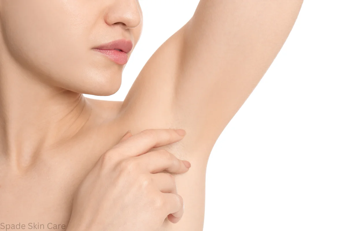 what is underarm laser hair removal