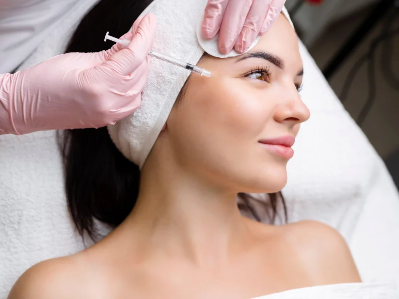 botox smile lines before and after